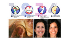 Curso 1 - Principios de la Bioestética