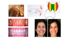 Curso 2 - Introducción a la Bioestética